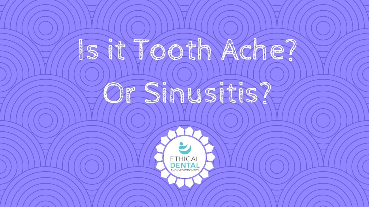 Is it toothache or sinusitis?