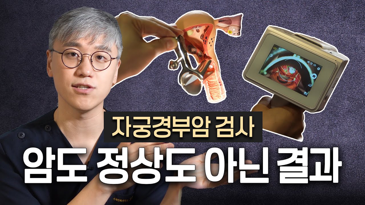 에스쿱스 아니고 아스쿠스? (그게 뭔데..)