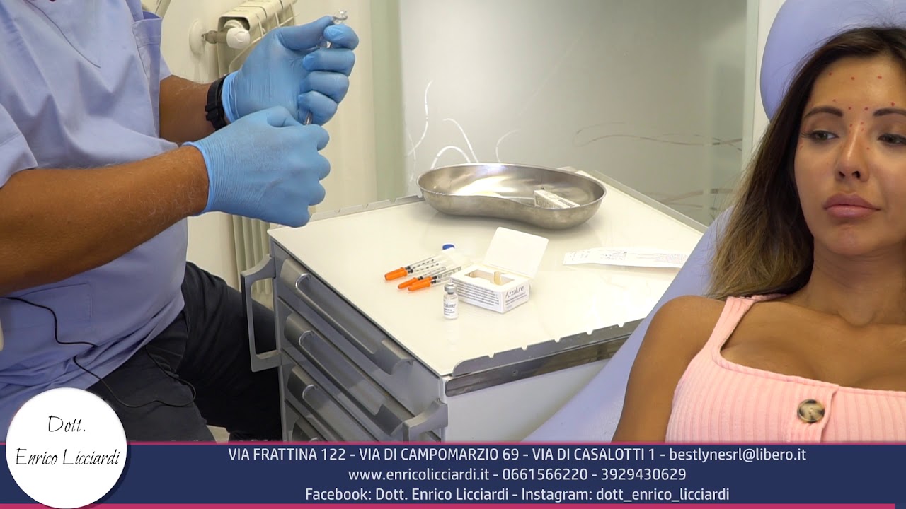 04  PREPARAZIONE DELLA TOSSINA BOTULINICA