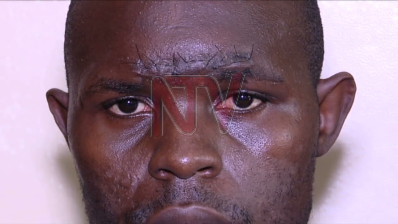 Old Kampala hospital in the spotlight over kidney removal