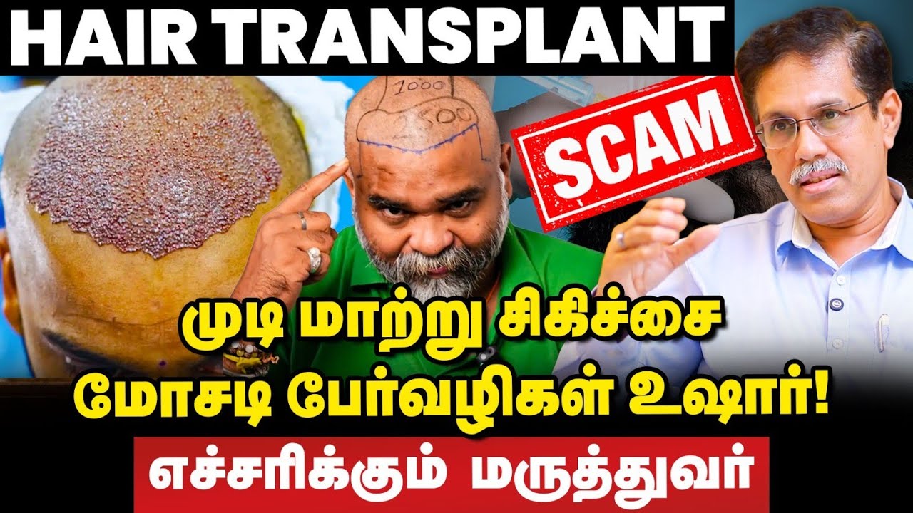 Hair Transplant Scam: முடிக்காக உயிரை பணையம் வைக்காதீர்கள் | எச்சரிக்கும் மருத்துவர்