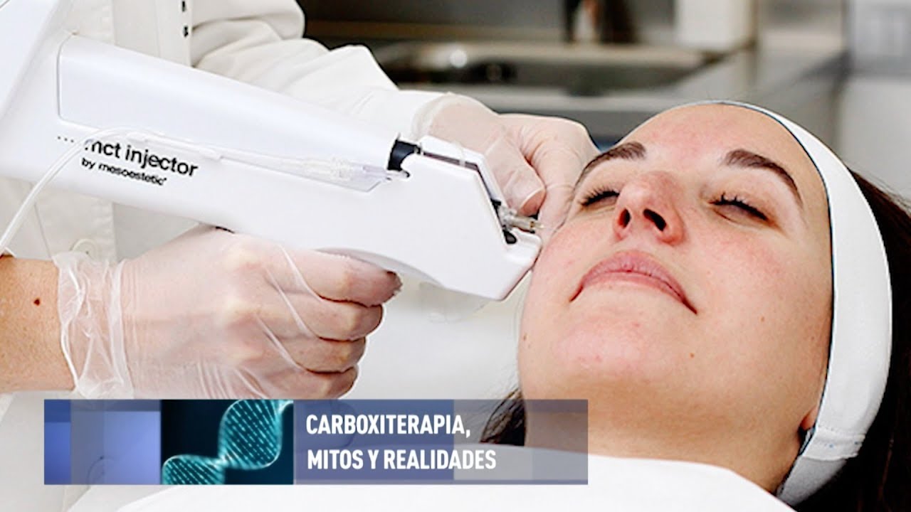 Mitos y realidades de la carboxiterapia