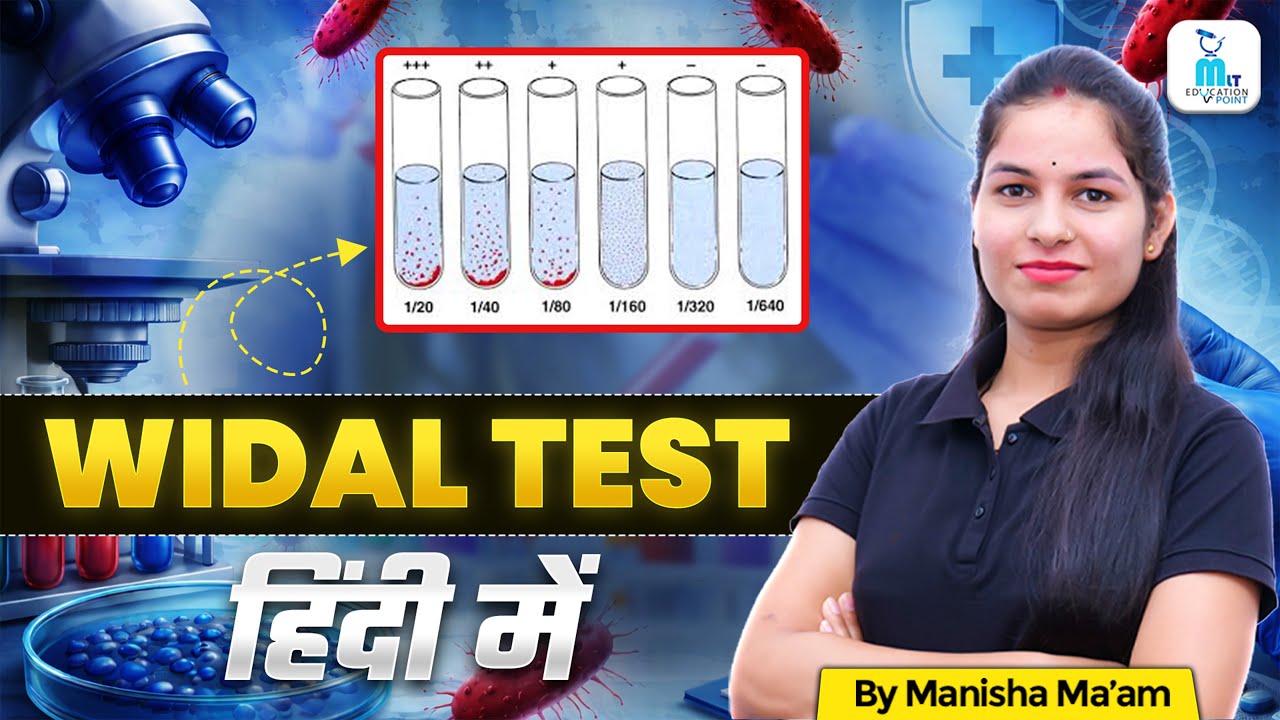 Widal Test in Hindi | Typhoid Test, Procedure, Interpretation | Typhoid Blood Test | By Manisha Maam