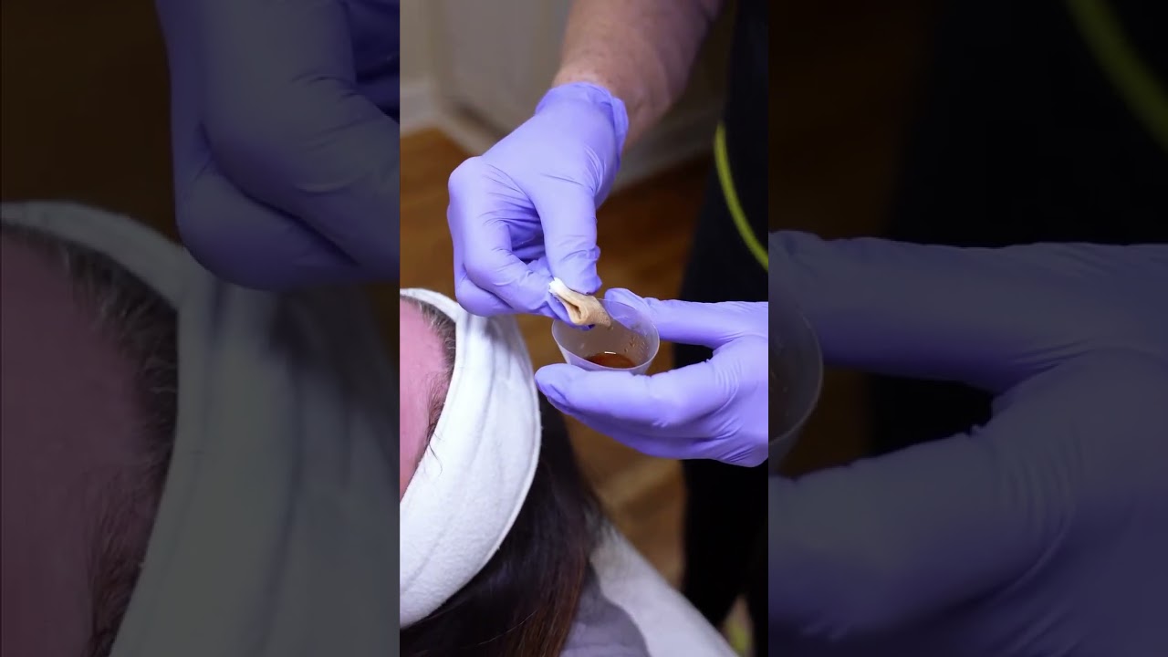 Fresh Skin Starts with VI Peel ✨🍃 Ready to hit reset on your skin? VI Peel is a powerful yet