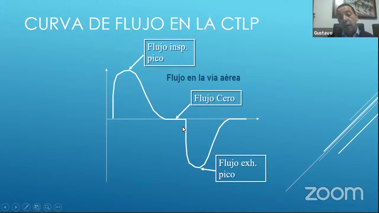 ¿Cómo interpretar las Curvas y Bucles?  ¿Qué debo monitorizar durante la ventilación mecánica?