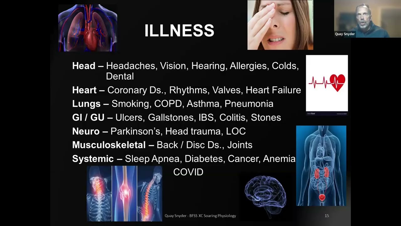 Physiological Considerations for Soaring Pilots 2026