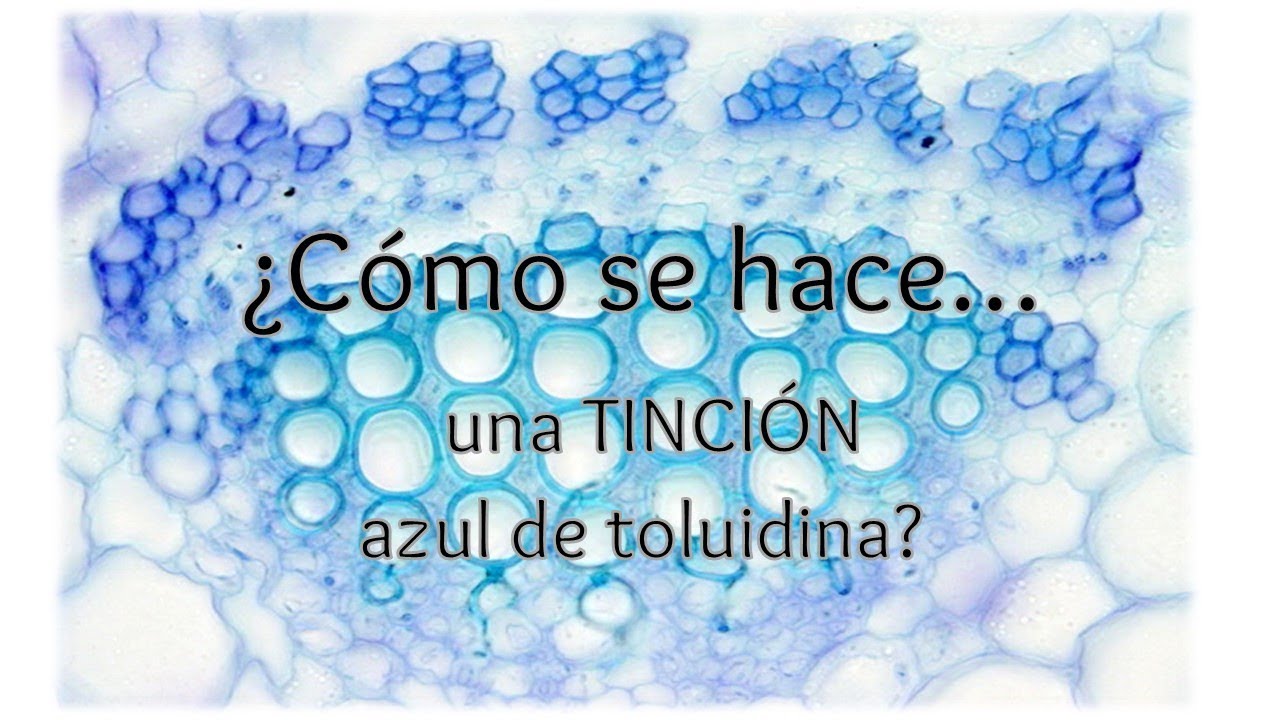 ¿Comó se hace una tinción azul de toluidina?