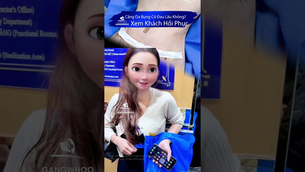 🌸 Căng Da Bụng C&oacute; Đau L&acirc;u Kh&ocirc;ng? Xem Kh&aacute;ch Hồi Phục Chỉ Sau 4 Ng&agrave;y #short #cangdabung #vong2