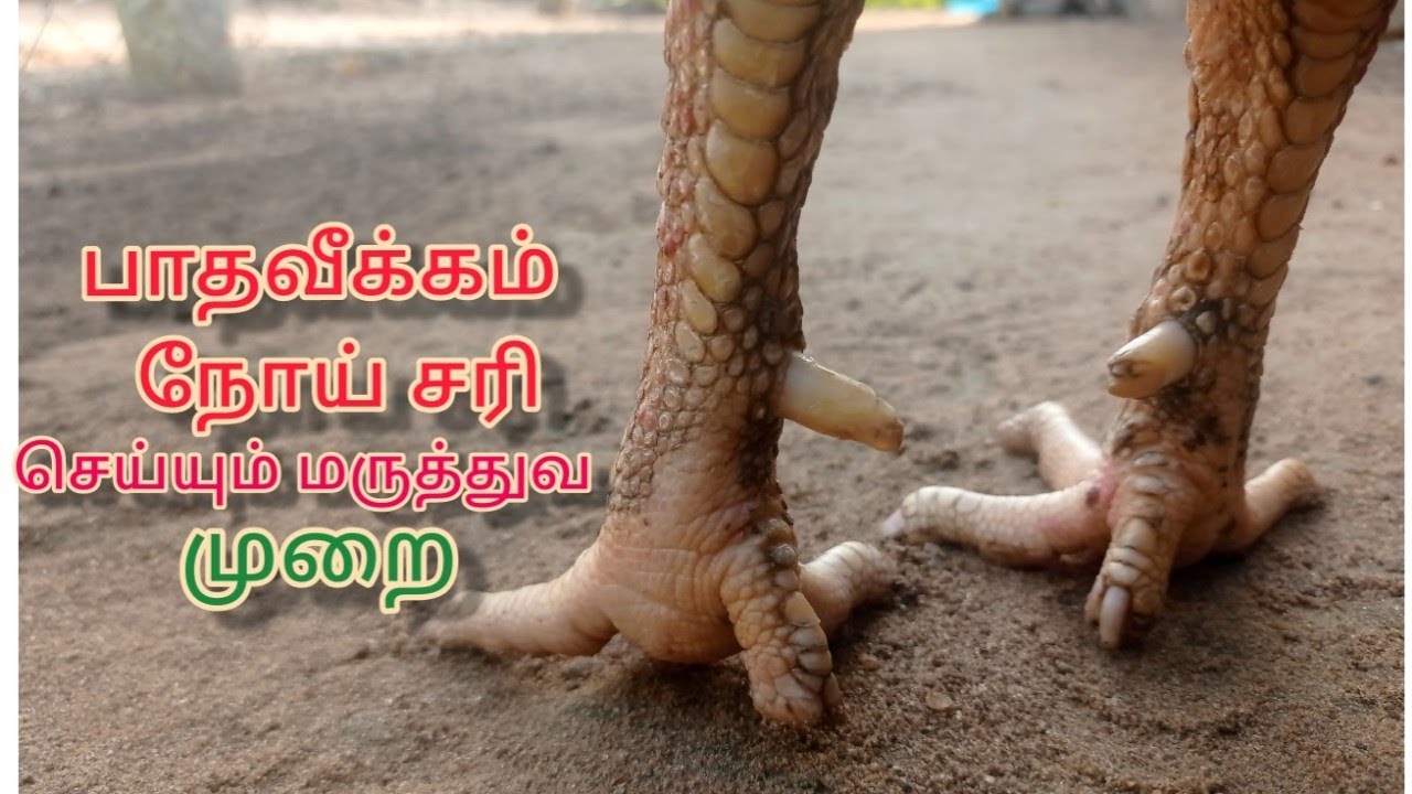 பாதவீக்கம் நோய் சரி செய்யும் மருத்துவம்