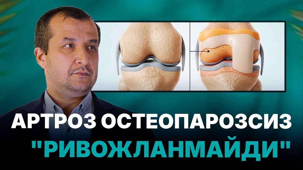 Артроз ОСТЕОПОРОЗСИЗ ривожланмайди I МАСТЕРКЛАСС I Доктор Одилбек