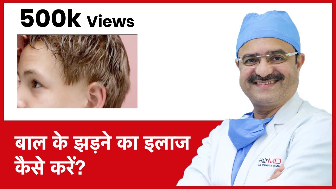 Young/Teenage Hair Loss: How to Treat Teenage Hair Loss (बाल के झड़ने का इलाज कैसे करें)| (In HINDI)