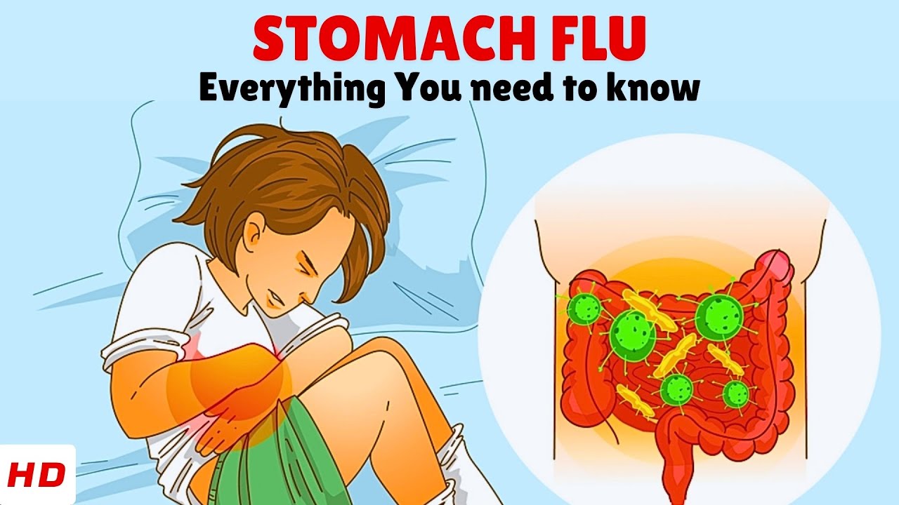 Viral Gastroenteritis (Stomach Flu) &ndash; Causes, Signs and Symptoms, Diagnosis & Treatment