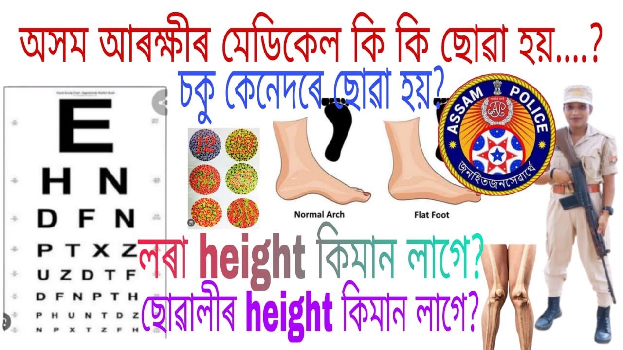 অসম আৰক্ষী(AP) Medical Test কেনেদৰে কৰা হয়..🤔ল'ৰা -ছোৱালী সকলোৱে কি কি চোৱা হয়.🤔 সকলো পাছ কৰিব নে🤔