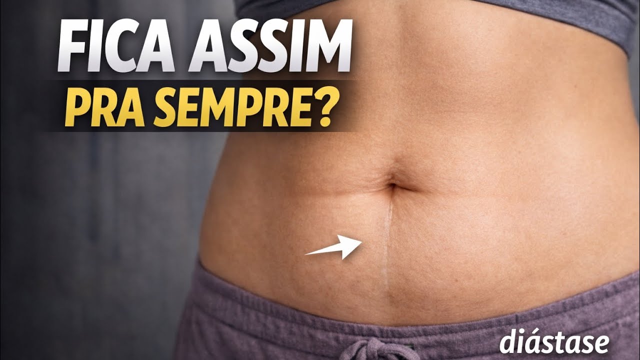 Diástase tem cura? Ou sua barriga vai ficar assim pra sempre? @tabataguimaraess 