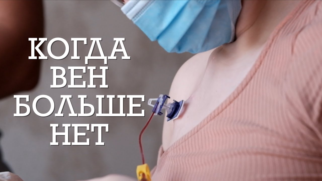 Порт. Центральный катетер. Portacath