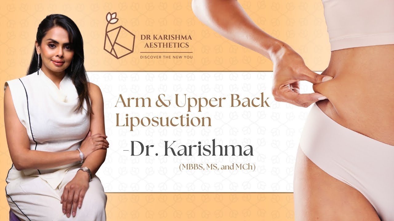 Returning Patient | Arm & Upper Back Liposuction | Dr Karishma Kagodu Best Plastic Surgeon Bengaluru
