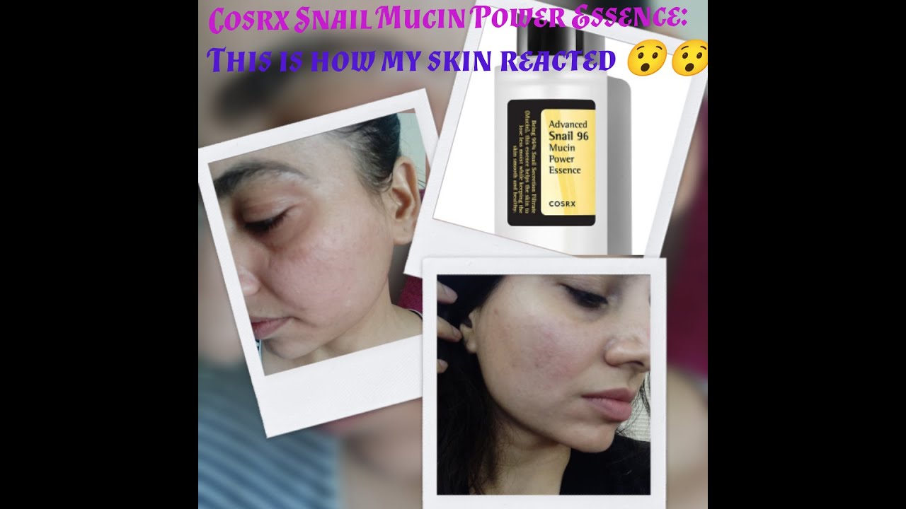 UPDATED REVIEW COSRX SNAIL MUCIN ESSENCE
