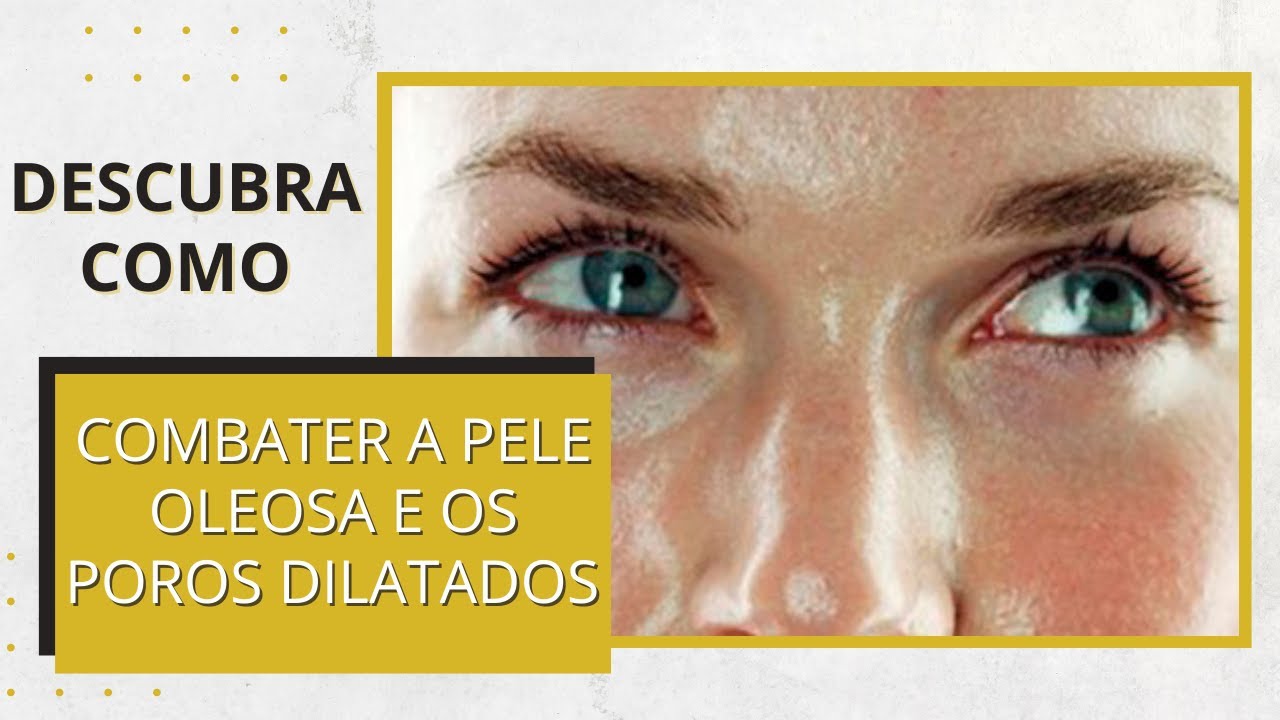 Descubra como combater a pele oleosa e os poros dilatados