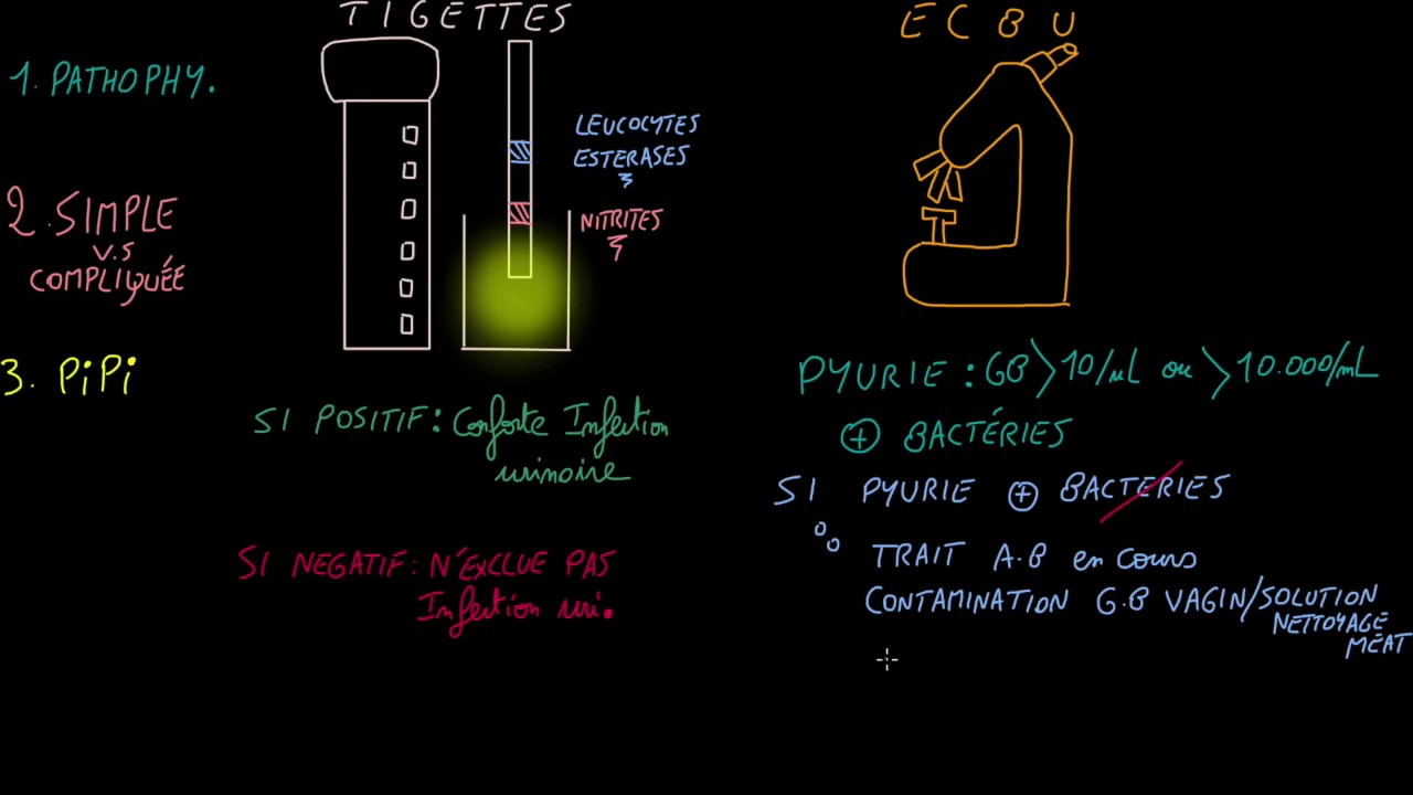 Infections urinaires - Sepsis woman - Episode 2 - Docteur Synapse