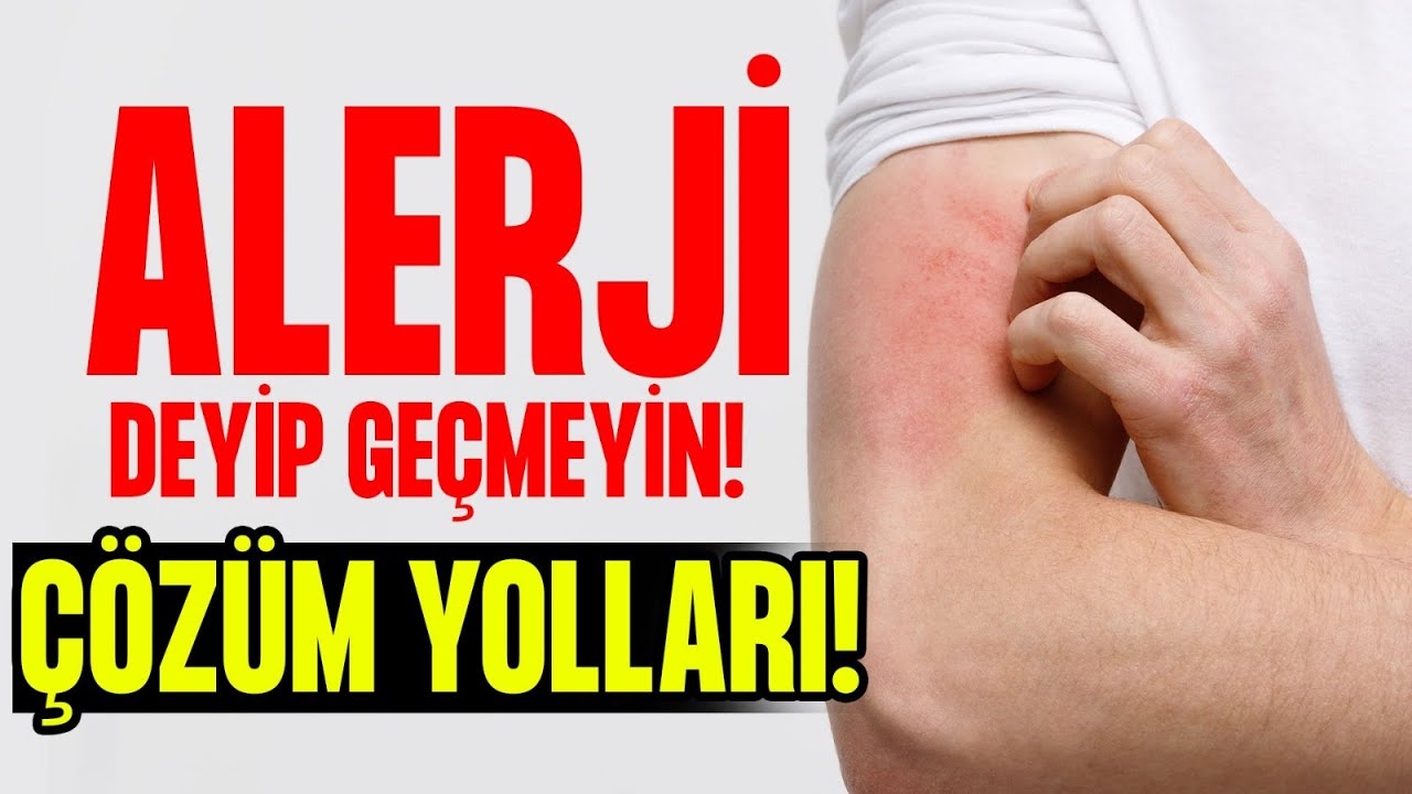 Alerji Deyip GEÇMEYİN! Alerjik Reaksiyonların Nedenleri Ve ÇÖZÜM YOLLARI! | Doktor Fitt