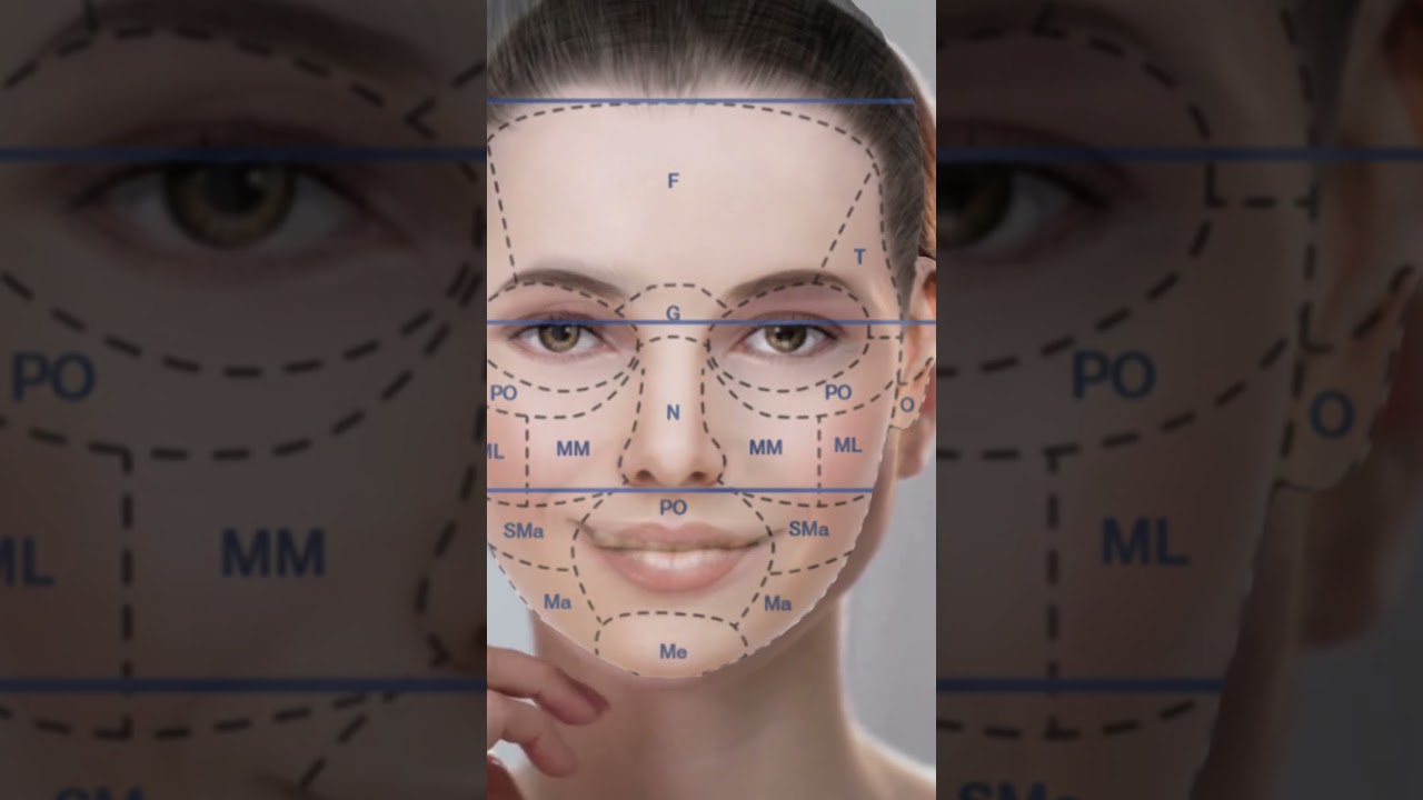 Injection Depth Matters: Know Your Layers in Aesthetic Procedure #medicalaesthetics #shorts