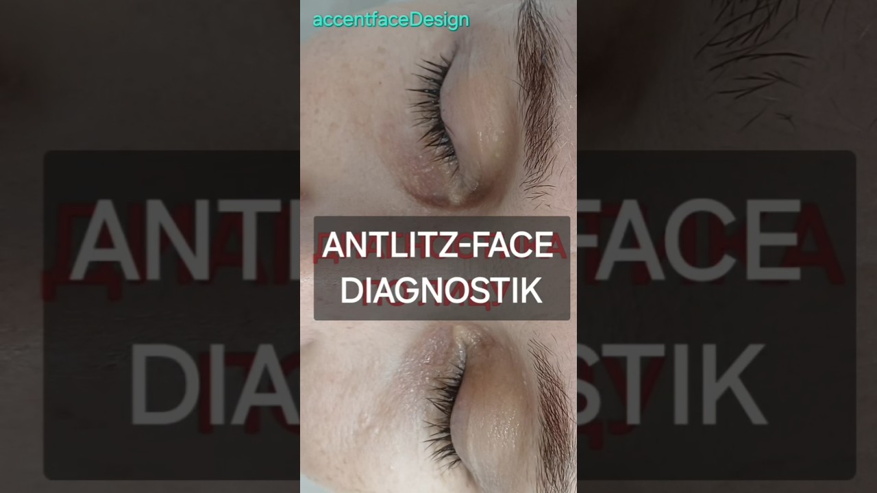 Mangelerscheinungen an Mineralien und Spurenelementen: Gesichtsdiagnostik Face diagnostics