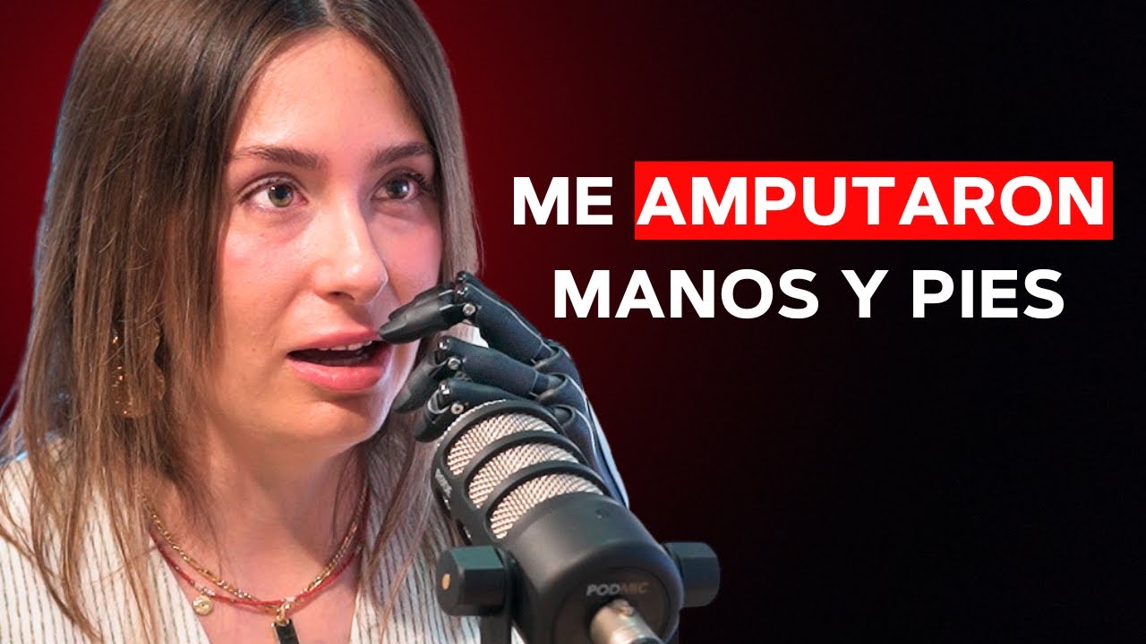 Salí del COMA pero PERDÍ mis Manos y mis Pies