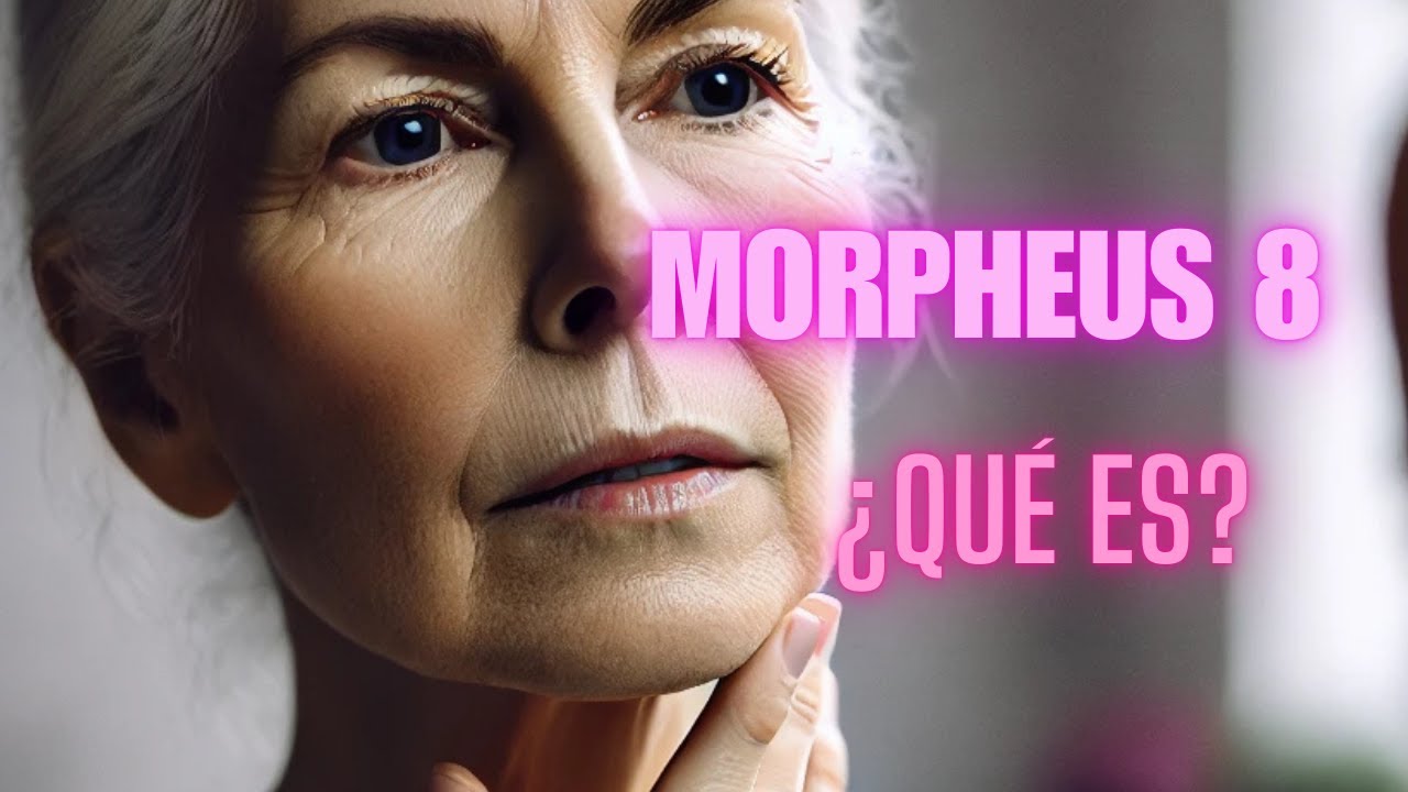 Morpheus 8. ¿Qué es?