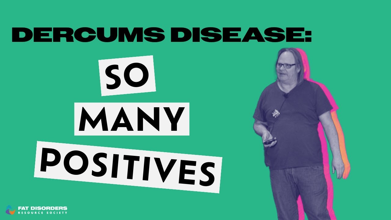 Dercums disease so many positives