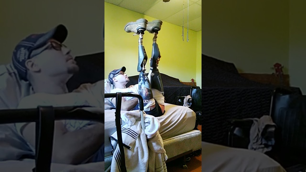 Bilateral AK amputee putting on legs and liners.