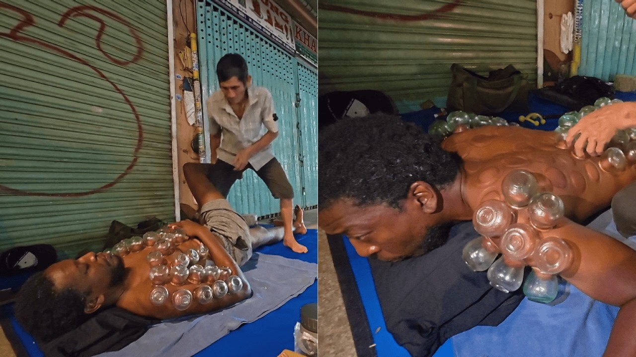 💆‍♂️ Legendary Street Massage Compilation – 40+ Years of Cupping, Stretching & More 🇻🇳