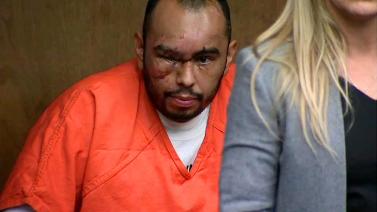 Man charged in crash that killed cop appears in court with major bruises, scars