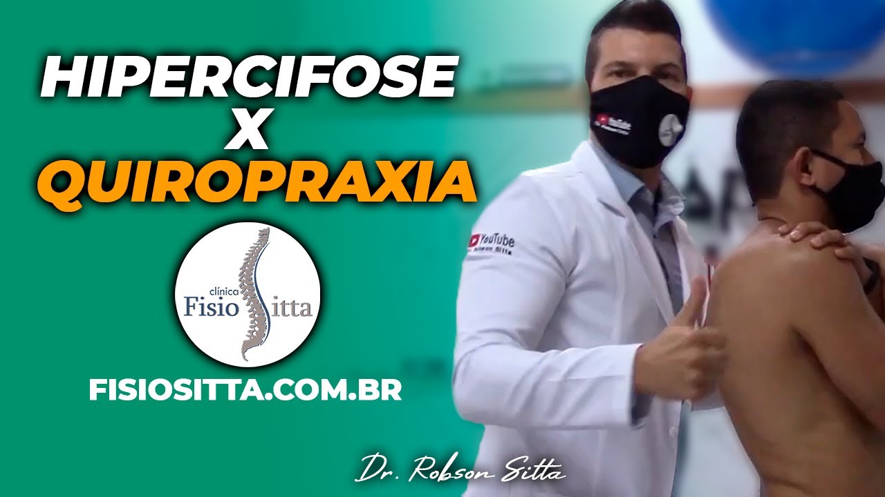 DOENÇA de SCHEUERMANN CIFOSE ESTRUTURAL QUIROPRAXIA CASO CLÍNICO Fisioterapia Dr. Robson Sitta