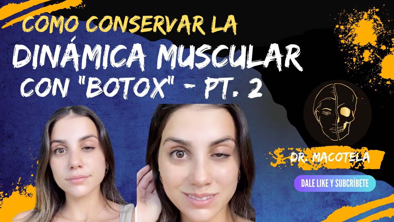 DINAMICA MUSCULAR Y BOTOX   parte 2