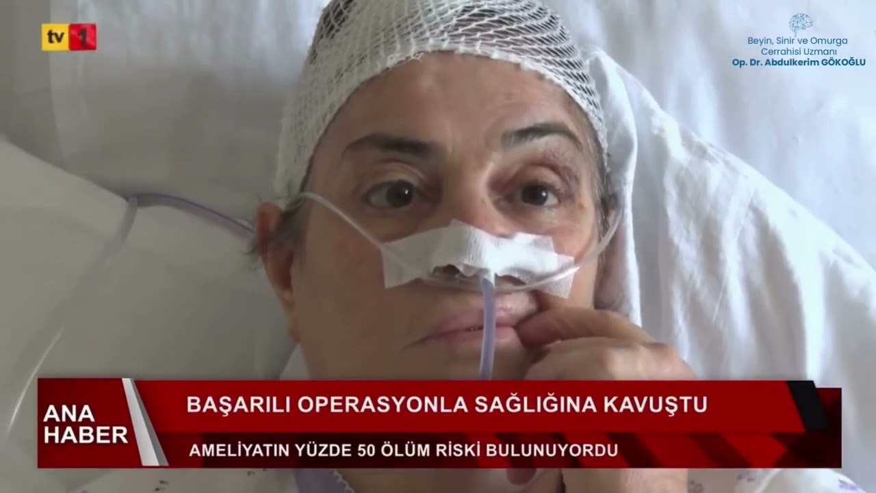 Trigeminal Nevralji Operasyonunda Yüksek Riskli Başarı.