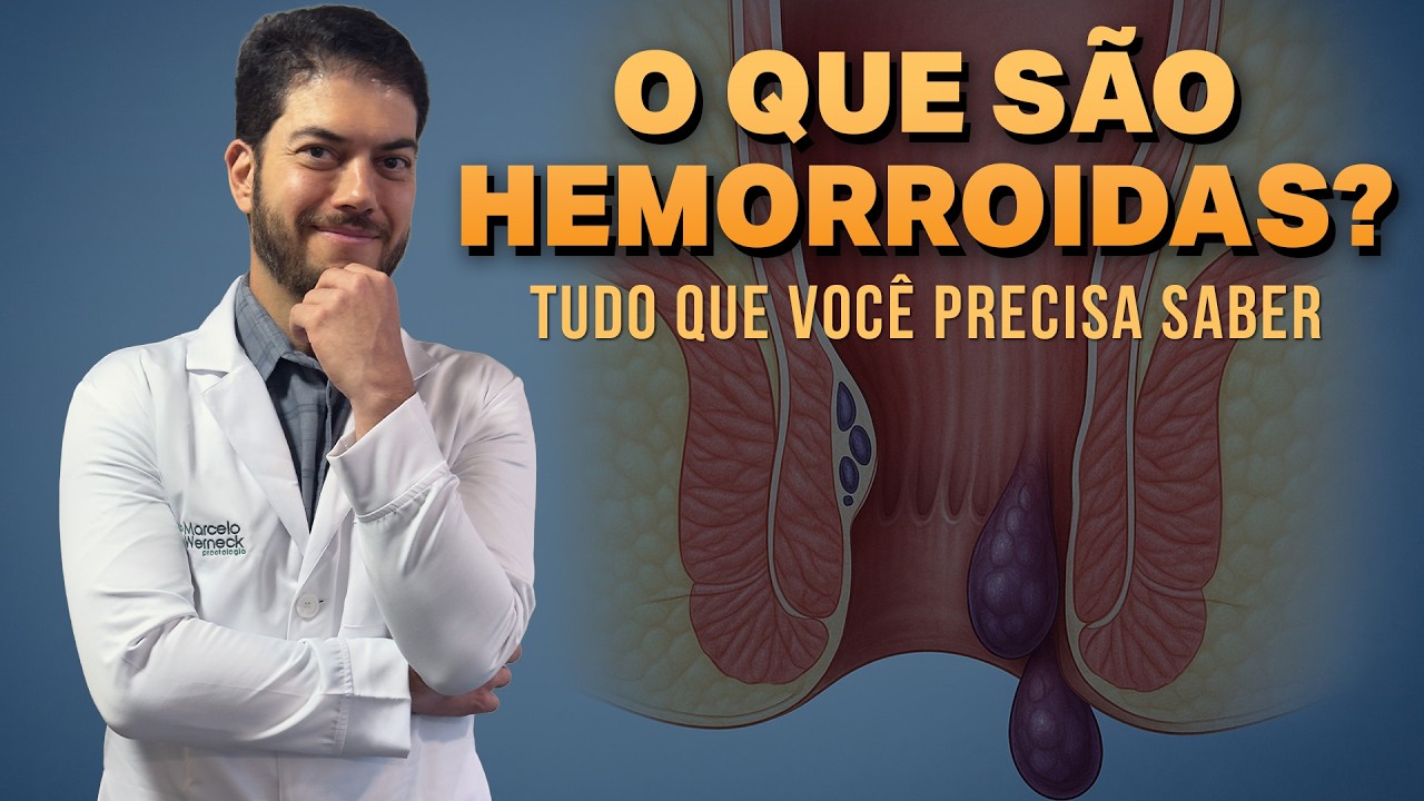 O que s&atilde;o as Hemorroidas? Aula com desenhos!