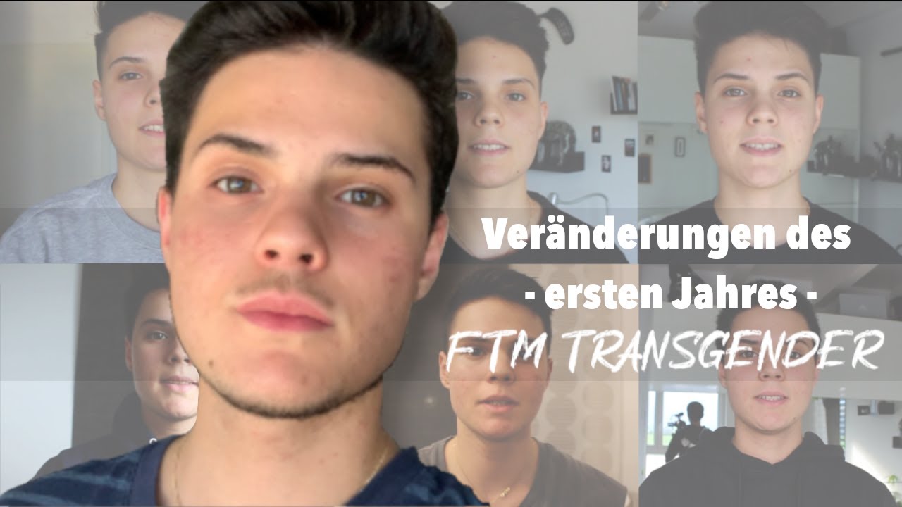 1 Jahr auf Testosteron & 2 Monate post OP Mastektomie (FTM Transgender)