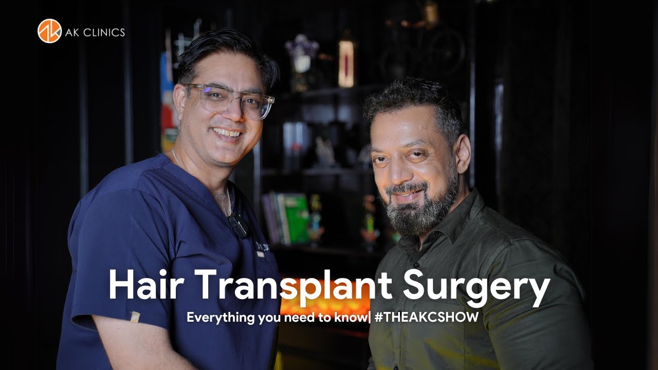 Hair Transplant - Everything You NEED To Know Before Surgery | Part 2