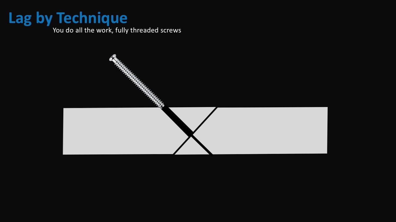 Lag Screws