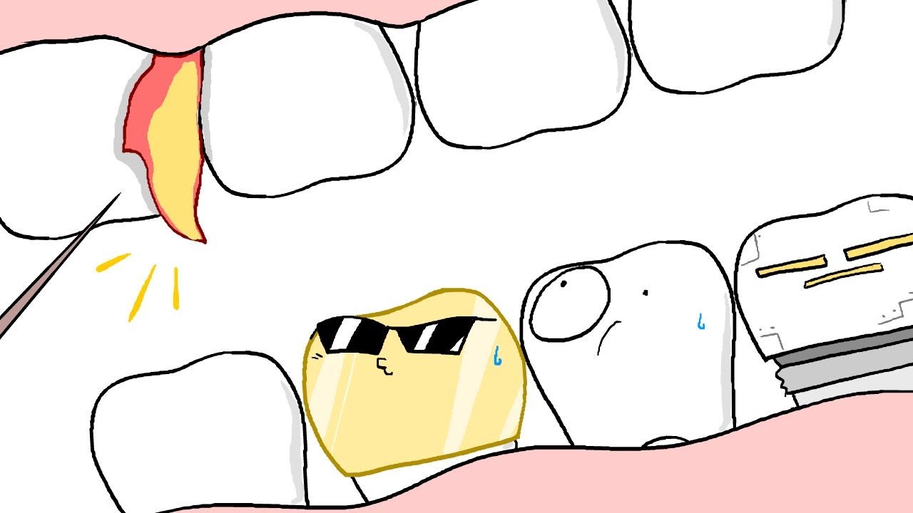uncomfortable teeth animation