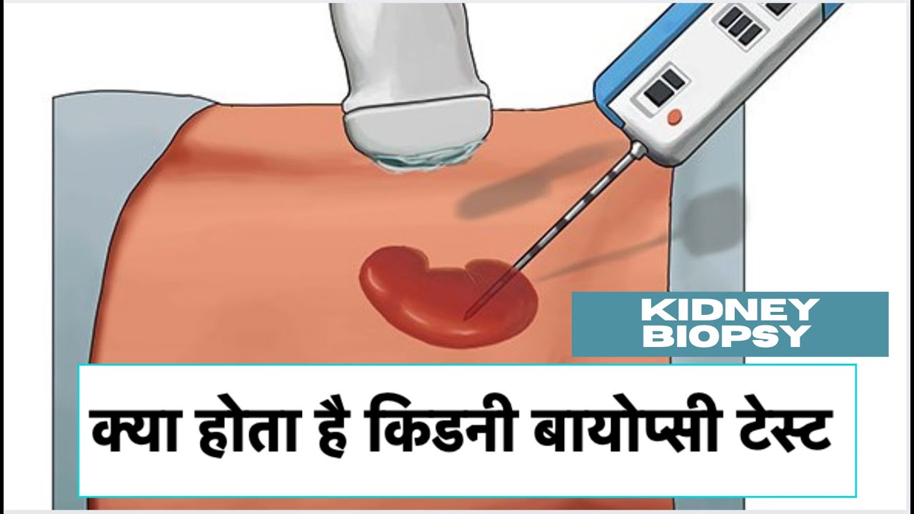 Kidney Biopsy I Kidney Biopsy after transplant I kidney transplant