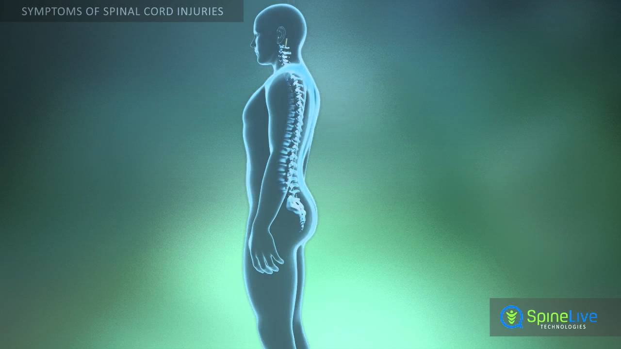 Spinal cord injury. Symptoms