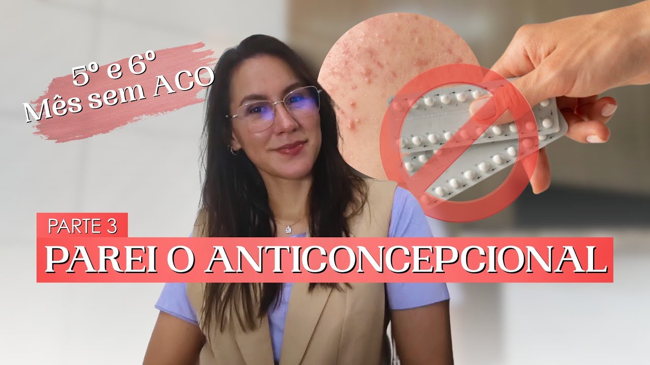 5° e 6° mês sem Pílula ACO e minha pele melhorou + Rotina de skincare atualizada