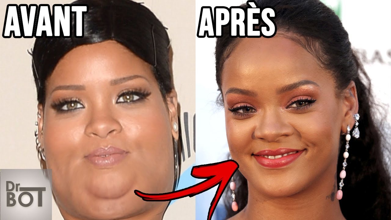 10 C&Eacute;L&Eacute;BRIT&Eacute;S QUI ONT PERDU DU POIDS DE FA&Ccedil;ON INCROYABLE| Dr Bot