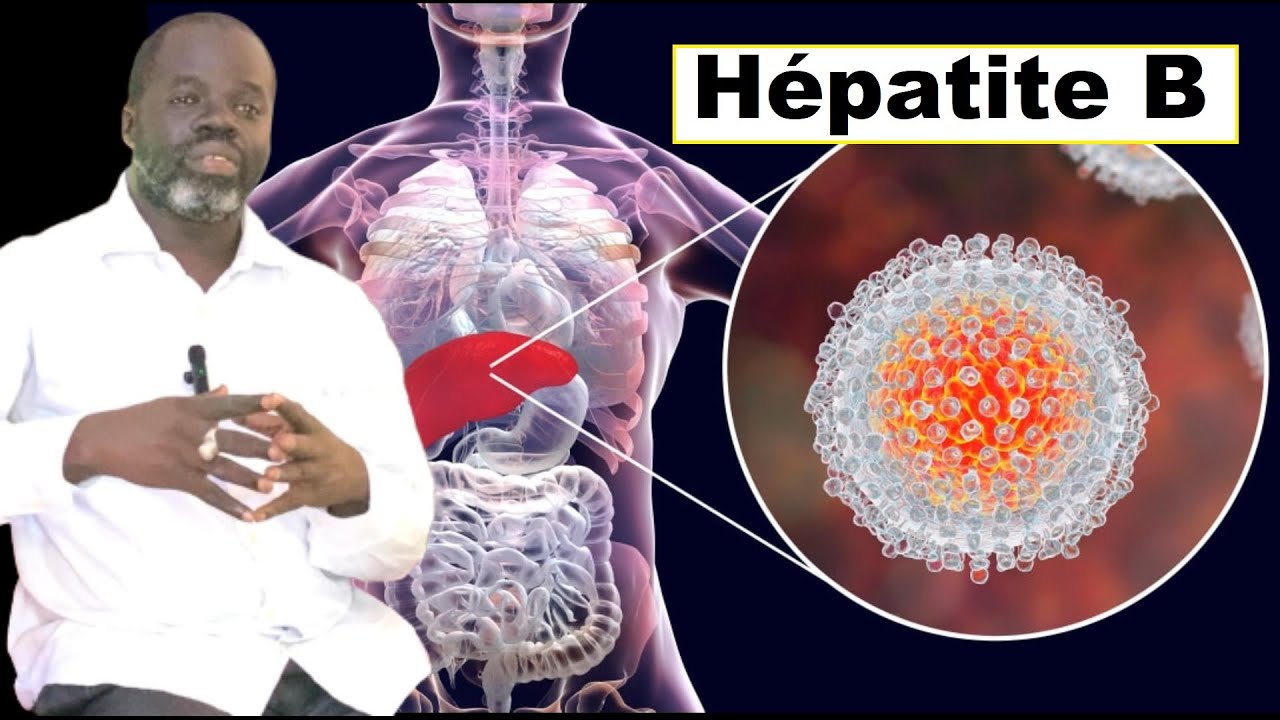 #1 - Hépatite B:  Symptômes et Causes? - Pr Ousmane Ndiaye - SAMA XALAAT TV