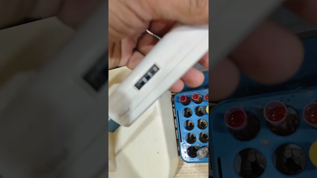 Serum SGPT/ALT test full detail 