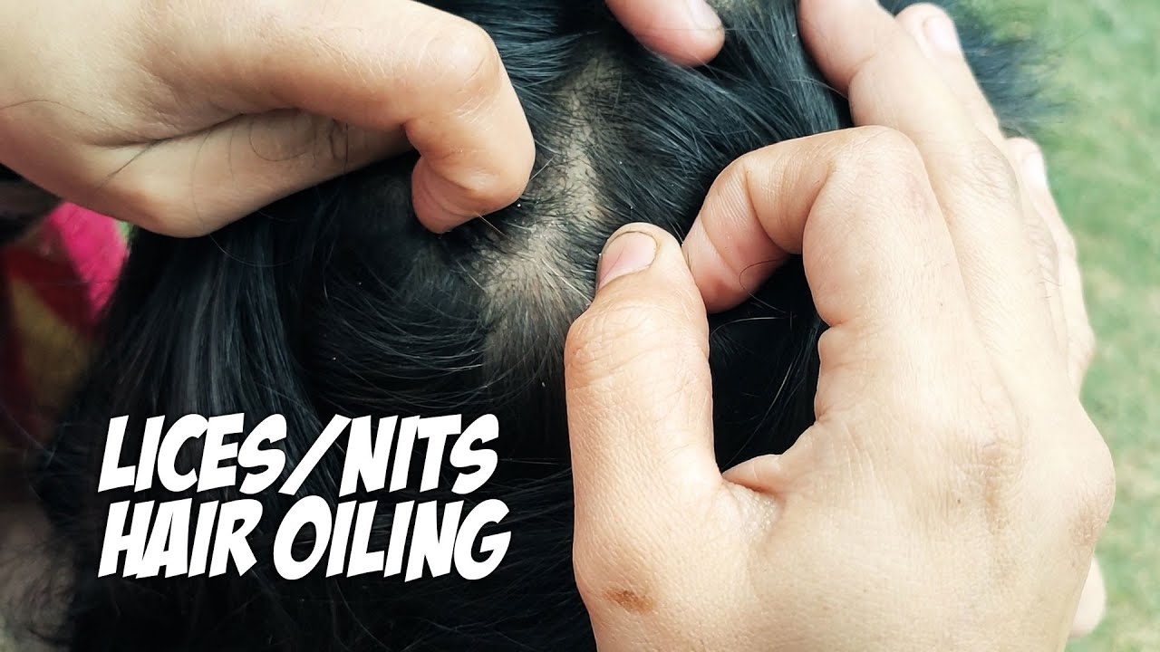 Picking Lices Nits Picking Heavy Hair Oiling Head Scalp View ASMR Pakistan