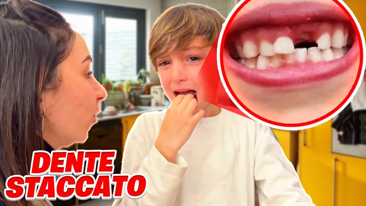 FIGLIODIEGO SI STACCA IL SUO PRIMO DENTE DA SOLO!