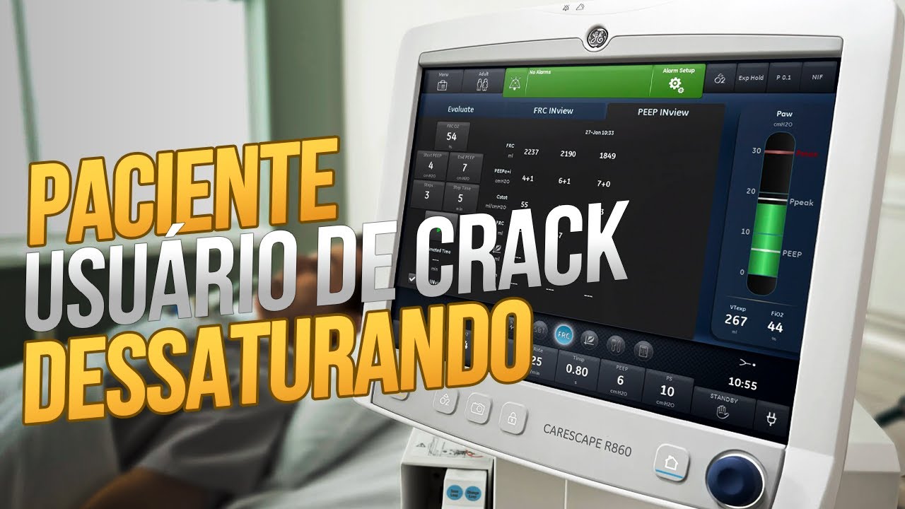 Desafio da ventila&ccedil;&atilde;o mec&acirc;nica: voc&ecirc; acertaria?