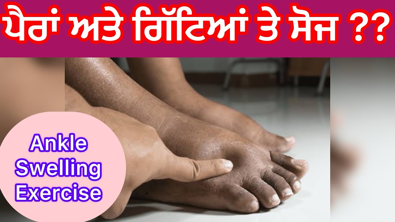 Ankle Swelling Exercises 🦵🦵🦵ਪੈਰਾਂ ਅਤੇ ਗਿੱਟੇਆਂ ਤੇ ਸੋਜ ??? Foot 🦶 And Ankle Swelling Exercises